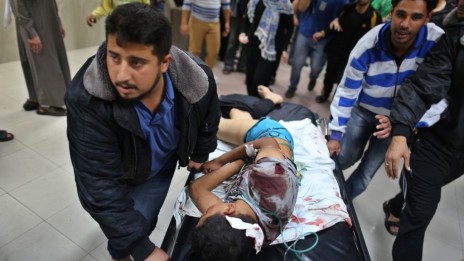 פלסטיני פצוע מובל לקבלת טיפול בבית-חולים בעזה, אתמול (צילום: ויסאם נאסר)