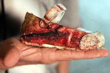 נעל הפעוטה שנפצעה מפגיעת באשקלון ב-14 במאי (צילום: אדי ישראל) 
