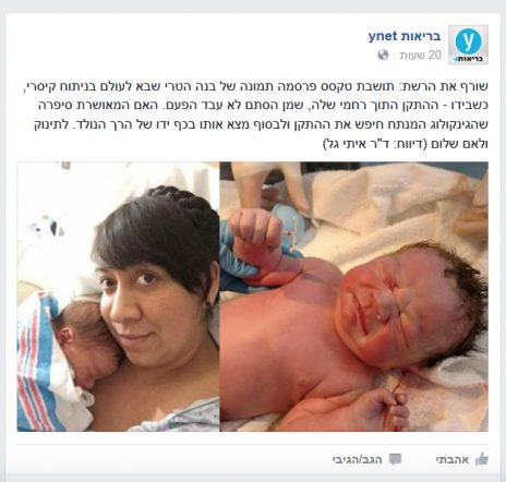 "מצא אותו בכף ידו של הרך הנולד". מתוך עמוד הפייסבוק של ynet בריאות (צילום מסך)