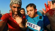 צלם העיתונות הפלסטיני מחמוד אל-ג'מאל מובל לטיפול רפואי לאחר שנפצע מרסיסים סמוך לרפיח, 10.8.2018 (צילום: עבד רחים ח'טיב)